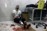 Un Syrien blessé reçoit des soins dans un hôpital de fortune dans le secteur Est d'Alep après avoir été victime d'un bombardement, le 18 novembre