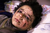 Omar, un garçon de 10 ans blessé dans un raid aérien qui a tué plusieurs membres de sa famille, reçoit des soins dans un hôpital de fortune dans la Ghouta orientale, une enclave rebelle près de Damas bombardée par le régime syrien le 25 février 2018