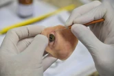 Le docteur Rodrigo Salazar-Gamarra travaille sur une prothèse conçue à partir d'images numériques pour reconstruire le visage de Denise Vicentin, le 3 décembre 2019 à l'hôpital de Sao Paulo