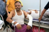 Des hommes blessés lors de frappes israéliennes sur le port de Hodeida, ville du Yémen tenue par les Houthis, reçoivent des soins dans un hôpital, le 21 juillet 2024