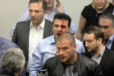 le leader de l'opposition de gauche Zoran Zaev, le visage ensanglanté, dans le chaos qui a suivi l'irruption dans l'hémicycle des  sympathisants du VMRO-DPMNE de l'ex-Premier ministre Nikola Gruevski, le 27 avril 2017 à Skopje 