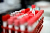 Tests sérologiques pour rechercher le Covid-19 analysés par un laboratoire en région parisienne, le 22 avril 2020