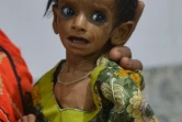 Une mère de 25 ans, Nazeeran, porte dans ses bras sa fillette qui souffre de malnutrition, le 25 mai 2018