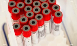 test coronavirus