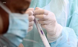 prélèvement clinique sainte-clotilde 