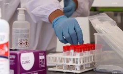 test coronavirus 