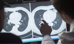 Vaccin contre le cancer du col de l’utérus : plus d’un million de vies sauvées dans les pays pauvres