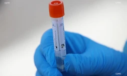 dépistage coronavirus 
