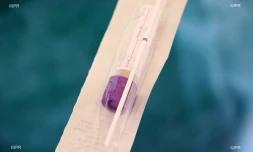 prélèvement clinique sainte clotilde 