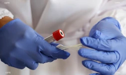 Test Coronavirus 