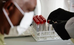 test coronavirus 