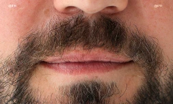 "Movember" : la moustache contre le cancer