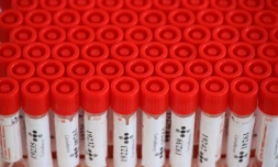 test coronavirus 