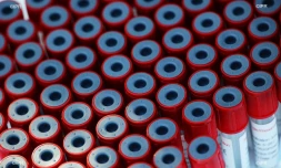 test coronavirus 