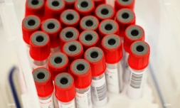 test coronavirus 