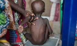 Une fillette souffrant de malnutrition le 30 juin 2016 Ă Maiduguri au Nigeria