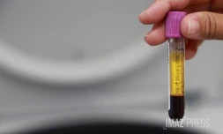  chikungunya analyse sang 