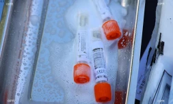 dépistage coronavirus 
