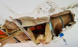 Logement dégradé à Montgaillard