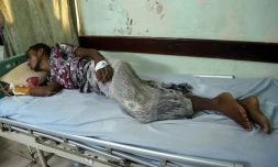 Un Yéménite blessé reçoit des soins après l'attaque aérienne de Hodeida, le 3 août 2018