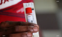 test coronavirus 