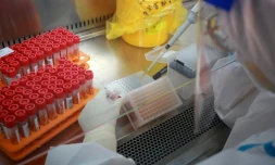 Près de 6 millions de tests Covid ont été effectués entre le 9 et le 15 août 2021 en France, un record atteint sous l'effet de l'extension du pass sanitaire, selon les données officielles rendues publiques jeudi