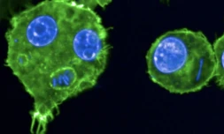 Des macrophages infectés par la bactérie Yersinia pestis photographiés en 2024 sur un cliché publié par l'Institut Pasteur, à Paris le 27 mai 2025 ( Institut Pasteur / Anne DERBISE )