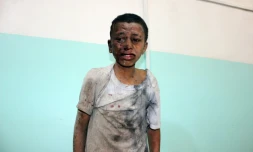Un enfant yéménite attend d'être pris en charge dans un hôpital après avoir été blessé dans une frappe sur la province rebelle de Saada, le 9 août 2018