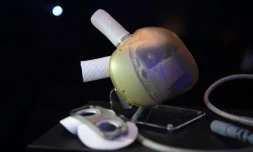 Un coeur artificiel fabriqué par la société de biotechnologie Carmat, à Paris, le 14 février 2017