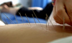 Seuls les médecins, sages-femmes et dentistes formés à l'acupuncture à l'université sont autorisés à pratiquer