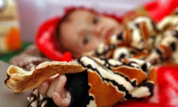 Un enfant yéménite souffrant de malnutrition, dans un hôpital de Sanaa, le 22 novembre 2017