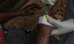 Une patiente atteinte du mpox reçoit un traitement en intraveineuse à l'hôpital de Kavumu, au nord de Bukavu, dans l'est de la RDC, le 24 août 2024