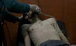Un homme pris en charge dans un hôpital de fortune après une attaque aux armes chimique par les troupes de Bachar al-Assad, à Derayya, dans le sud-ouest de Damas le 13 janvier 2014