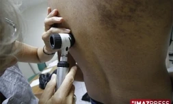 Consultation chez un dermatologue (photo archives)