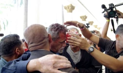 Le député d'opposition au gouvernement Maduro, Americo De Grazia (C), blessé à la tête par les manifestants qui ont fait irruption dans le parlement, le 5 juillet 2017 à Caracas