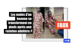   Cette photo montre un acteur pendant un tournage et non un homme victime d'une malédiction