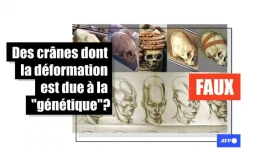   La forme de ces crânes retrouvés au Pérou est due à une pratique culturelle et n'a rien à voir avec la génétique