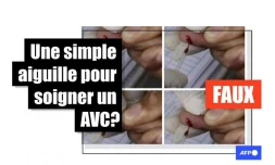   Non, se piquer les doigts avec une aiguille ne sauve pas d&rsquo;un AVC