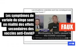La multiplication de cas de variole du singe en Europe n'a pas de rapport avec la vaccination anti-Covid