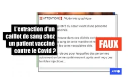   Cette vidéo ne montre pas l'extraction d'un caillot de sang chez un patient vacciné contre le Covid
