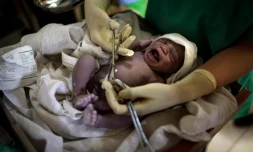   Ces affirmations sur les vaisseaux du cordon ombilical sont trompeuses