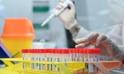 Collecte d'échantillon pour analyse du virus dans un laboratoire à Londres, le 21 janvier 2021