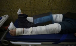 Un blessé afghan soigné dans un hôpital à Kaboul le 31 mai 2017