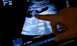 Les fans pourront revoir l'annonce de la gestation d'un, puis deux bébés, avec des images des échographies qui ont révélé la présence des f?tus.