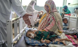 Un enfant souffrant de malnutrition reçoit des soins, à l'hôpital Mirwais de Kandahar (Afghanistan), le 27 septembre 2021