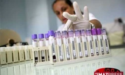 Le laboratoire de biologie du CHD de Bellepierre (Saint-Denis)