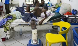 Shukurani Konde Tuva (g), souffrant d'une nécrose des tissus de sa jambe gauche causée par le venin cytotoxique provenant de la morsure d'une vipÚre heurtante, est pris en charge à l'hÎpital du sous-comté de Malindi, le 7 avril 2025 au Kenya