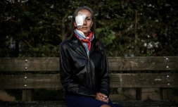 La spectatrice française Corine Remande, qui a perdu la vue à l'?il droit après avoir été blessée par une balle de Brooks Koepka lors de la journée d'ouverture de la Ryder Cup, ici à Lyon le 3 octobre 2018