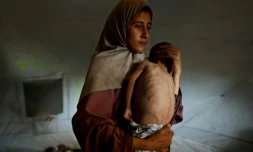 Hidaya, une mère palestinienne de 31 ans, porte son fils malade de 18 mois, Mohammed al-Mutawaq, qui présente des signes de malnutrition, au camp de réfugiés d'Al-Shati, à l'ouest de la ville de Gaza, le 24 juillet 2025