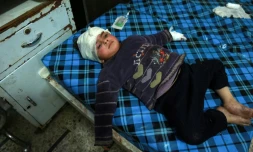 Un enfant syrien est soigné dans un hôpital de Douma, dans la Ghouta orientale, le 3 mars 2018